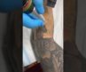 SUSLASER Picolaser Tattoo Removal Whole Arm Tattoo Removal With Less Chance Of Forming Bubbles