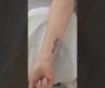 Tattoo removal #acnetreatment #doctor #beauty #laser #satisfying #skincare #tattoo #esthetician #usa