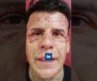 Brazil’s Most Tattooed Man Removes All His Tattoos