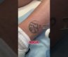 “tattoo lesar remover”🤯😳