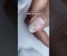 Burned nails after gel manicure ?! 😮😳