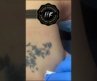 Plasma Tattoo Removal #shorts