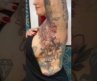 How Laser Tattoo Removal Works😮#usa