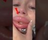 What Happened To Her Lips? 😱 #shorts