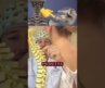 What is the bump on the back of your neck?! (Spine expert explains) 🤯