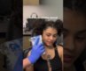 First face tattoo removal session complete!✅